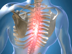 Douleur douloureuse récurrente ou persistante associée à une ostéochondrose dans la poitrine