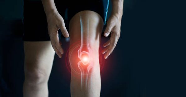 Arthrose de l'articulation du genou