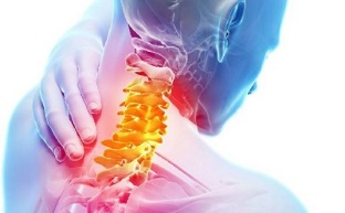 Symptômes de l'ostéochondrose de la colonne cervicale